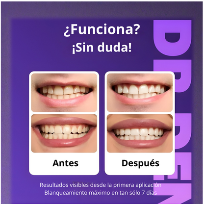 Tiras blanqueadoras sin peróxido