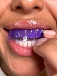 Tiras blanqueadoras sin peróxido